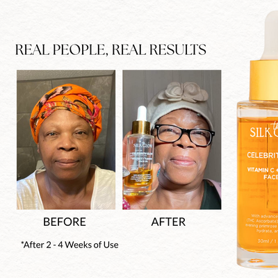 before and after celebrity glow results